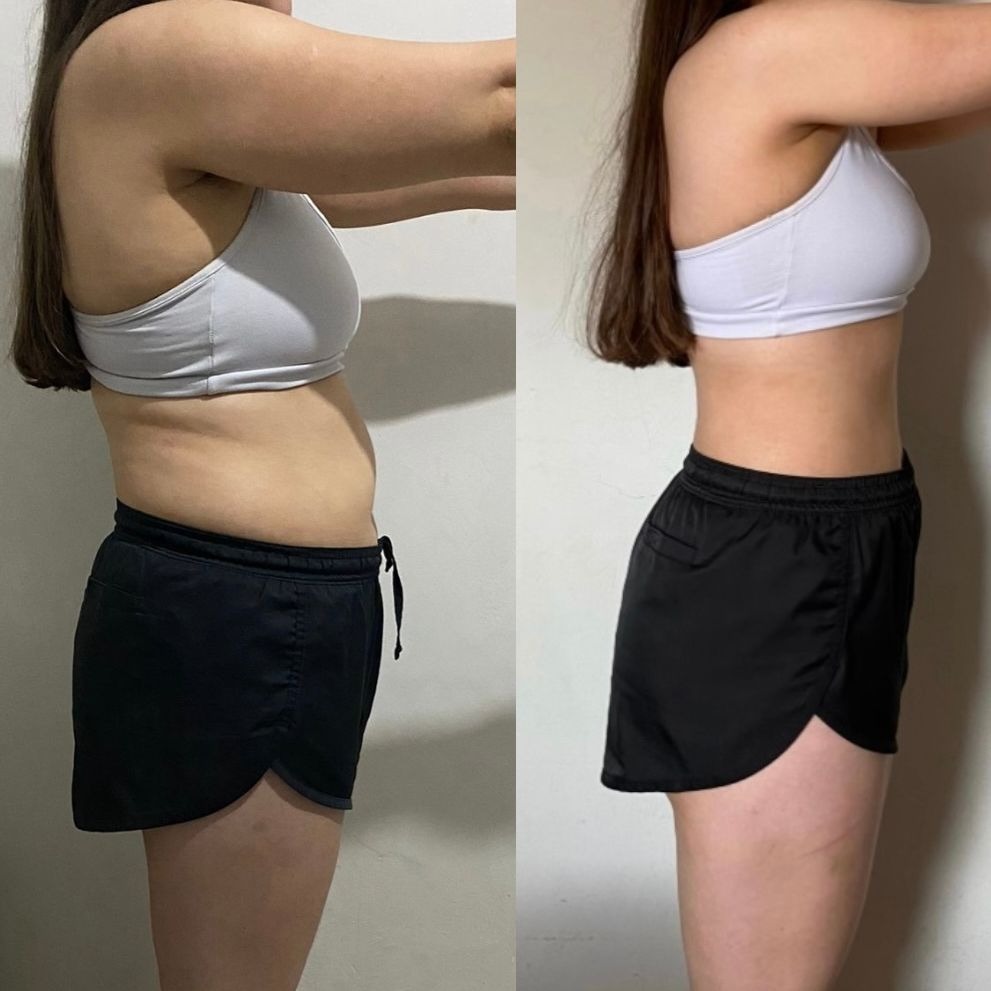 Resultado antes e depois - aluna 3